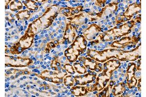 ABIN6265723 and ABIN6267021 at 1/100 staining Mouse kidney tissue by IHC-P. (TRHR antibody  (Internal Region))
