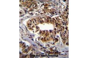 Immunohistochemistry (Paraffin-embedded Sections) (IHC (p)) image for anti-Carbamoyl-Phosphate Synthetase 2, Aspartate Transcarbamylase, and Dihydroorotase (CAD) (AA 787-816), (Middle Region) antibody (ABIN950999)