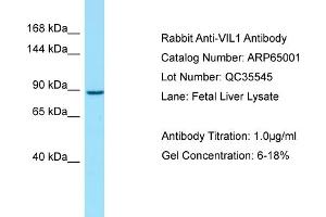 Western Blotting (WB) image for anti-Villin 1 (VIL1) (C-Term) antibody (ABIN971991) (Villin 1 antibody  (C-Term))