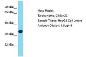 KNSTRN anticorps  (AA 151-200)