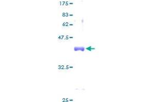 SDS-PAGE (SDS) image for Small Nuclear Ribonucleoprotein D2 Polypeptide 16.5kDa (SNRPD2) (AA 1-118) protein (GST tag) (ABIN1784925)