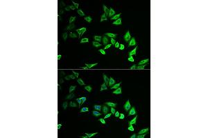 Immunofluorescence analysis of U2OS cells using MYOZ2 antibody. (MYOZ2 antibody)