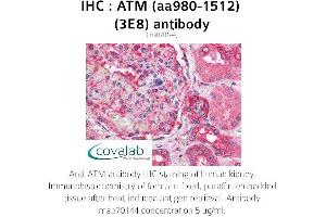 Image no. 1 for anti-Ataxia Telangiectasia Mutated (ATM) (AA 980-1512) antibody (ABIN1723092) (ATM antibody  (AA 980-1512))