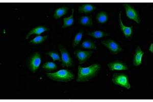 Immunofluorescent analysis of A549 cells using ABIN7142744 at dilution of 1:100 and Alexa Fluor 488-congugated AffiniPure Goat Anti-Rabbit IgG(H+L) (RPL13A antibody  (AA 63-190))
