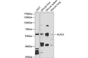 Western blot analysis of extracts of various cell lines, using  antibody (ABIN6129839, ABIN6136757, ABIN6136758 and ABIN6222179) at 1:1000 dilution. (ALAS2 antibody  (AA 50-320))