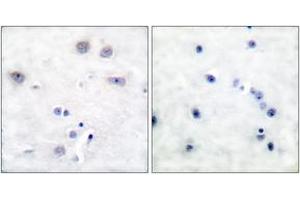 Immunohistochemistry analysis of paraffin-embedded human brain tissue, using Shc (Ab-427) Antibody. (SHC1 antibody  (AA 393-442))