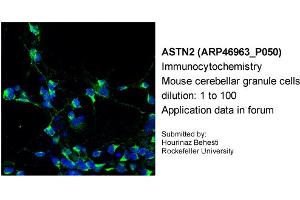 Immunocytochemistry --Sample Type: Mouse cerebellar granule cellsDilution: 1:100 (Astrotactin 2 antibody  (N-Term))