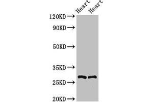 Western Blot Positive WB detected in: Rat heart tissue, Mouse heart tissue All lanes: MYF5 antibody at 2. (MYF5 antibody  (AA 1-255))
