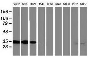 Image no. 3 for anti-Annexin A3 (ANXA3) antibody (ABIN1496646) (Annexin A3 antibody)
