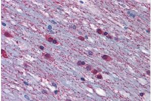 Anti-ADRA1A antibody  ABIN1048308 IHC staining of human brain.