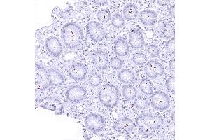 A moderate number of helicobacter pylori in a stomach sample (Helicobacter Pylori antibody  (AA 323-445))