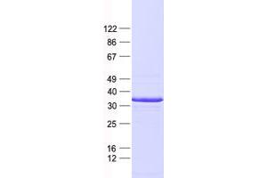 Validation with Western Blot (KLF6 Protein (His tag))