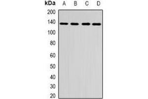 Western blot analysis of CENP-C expression in A431 (A), HepG2 (B), mouse brain (C), rat brain (D) whole cell lysates.