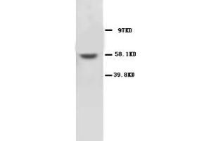 MMP16 Polyclonal Antibody