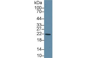 Western Blot; Sample: Human Liver lysate; Primary Ab: 1µg/ml Rabbit Anti-Human GSTk1 Antibody Second Ab: 0. (GSTK1 antibody  (AA 7-222))