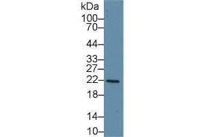Western Blot; Sample: Human Liver lysate; Primary Ab: 1µg/ml Rabbit Anti-Human GSTk1 Antibody Second Ab: 0. (GSTK1 antibody  (AA 7-222))