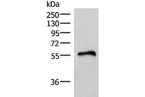 Western blot analysis of Human heart tissue lysate using RETREG1 Polyclonal Antibody at dilution of 1:400 (FAM134B antibody)