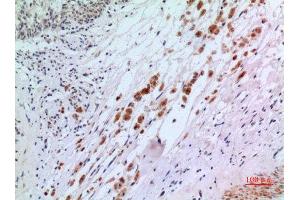 Immunohistochemistry (IHC) analysis of paraffin-embedded Human Brain, antibody was diluted at 1:100. (IFN-AlphaR2 (N-Term) antibody)