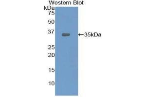 Western Blotting (WB) image for anti-Oxidized Low Density Lipoprotein (Lectin-Like) Receptor 1 (OLR1) (AA 51-314) antibody (ABIN1859679) (OLR1 antibody  (AA 51-314))