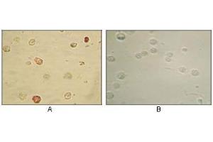 Immunocytochemistry analysis of TPA induced BCBL-1 cells (A) and uninduced BCBL-1 cells (B) using KSHV ORF45 antibody with AEC staining. (KSHVORF45 antibody)