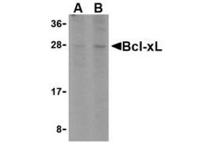 Image no. 1 for anti-BCL2-Antagonist/killer 1 (BAK1) (N-Term) antibody (ABIN206321) (BAK1 antibody  (N-Term))