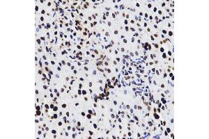 Immunohistochemistry of paraffin-embedded rat kidney tissue, using HMGB1 antibody. (HMGB1 antibody)