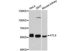 Western blot analysis of extracts of various cell lines, using ATL3 antibody. (ATL3 antibody  (AA 360-440))