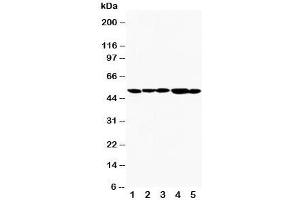 Western blot testing of TIM-1 antibody and Lane 1:  SMMC-7721;  2: HeLa;  3: PANC;  4: MM231;  5: MM453. (HAVCR1 antibody  (AA 289-307))