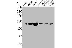 Western Blot analysis of A549 SW620 HT29 Jurkat mouse kidney mouse lung cells using CD133 Polyclonal Antibody