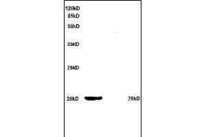 Formalin-fixed and paraffin embedded rat kidney tissue labeled with Anti Ferritin Polyclonal Antibody, Unconjugated (ABIN759641) at 1:200 followed by conjugation to the secondary antibody and DAB staining (FTH1 antibody  (AA 1-100))