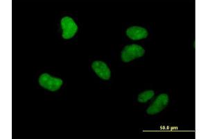 Immunofluorescence of purified MaxPab antibody to WHSC1 on HeLa cell. (WHSC1 antibody  (AA 1-647))