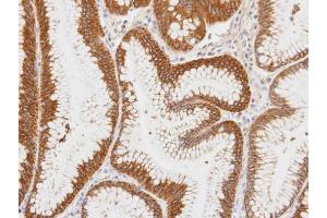 IHC-P Image Immunohistochemical analysis of paraffin-embedded human gastric tissue, using Centaurin alpha 1, antibody at 1:100 dilution. (ADAP1 antibody  (C-Term))