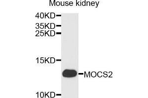 Western blot analysis of extracts of mouse kidney cells, using MOCS2 antibody. (MOCS2 antibody)