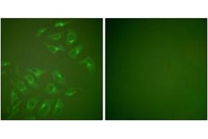 Immunofluorescence analysis of HepG2 cells, using MMP-13 Antibody. (MMP13 antibody  (AA 10-59))