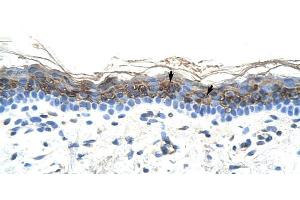 Human Skin (ZIC2 antibody  (C-Term))