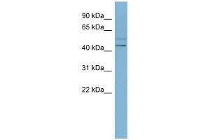 SLC46A1 antibody used at 1 ug/ml to detect target protein. (SLC46A1 antibody)