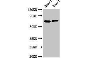 Western Blot Positive WB detected in: Rat heart tisseu, Mouse heart tissue All lanes: FASTKD2 antibody at 8 μg/mL Secondary Goat polyclonal to rabbit IgG at 1/50000 dilution Predicted band size: 82, 75 kDa Observed band size: 75 kDa (FASTKD2 antibody  (AA 117-203))