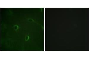 Immunofluorescence analysis of HuvEc cells, using IR (Ab-1355) Antibody.
