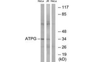 Image no. 1 for anti-ATP Synthase, H+ Transporting, Mitochondrial F1 Complex, gamma Polypeptide 1 (ATP5C1) (AA 131-180) antibody (ABIN2890140) (ATP5C1 antibody  (AA 131-180))
