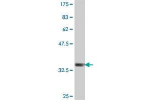 Western Blot detection against Immunogen (36. (USP45 antibody  (AA 106-196))