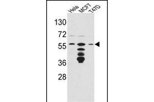 Western blot analysis of FKBP4 Antibody (Center) (ABIN391579 and ABIN2841513) in Hela,MCF7,T47D cell line lysates(35 μg/lane). (FKBP4 antibody  (AA 186-216))
