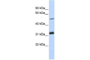anti-Tandem C2 Domains, Nuclear (TC2N) (Middle Region) antibody