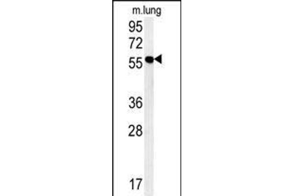 ZMYND10 antibody  (C-Term)