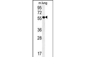 ZMYND10 Antibody (C-term) (ABIN652018 and ABIN2840499) western blot analysis in mouse lung tissue lysates (15 μg/lane). (ZMYND10 antibody  (C-Term))