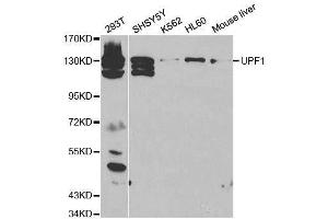 Western Blotting (WB) image for anti-UPF1 Regulator of Nonsense Transcripts Homolog (UPF1) (AA 270-370) antibody (ABIN3022069)