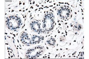 Immunohistochemical staining of paraffin-embedded breast tissue using anti-MAP2K2 mouse monoclonal antibody. (MEK2 antibody)