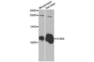Western blot analysis of extracts of various cell lines, using S100B antibody. (S100B antibody  (AA 1-92))