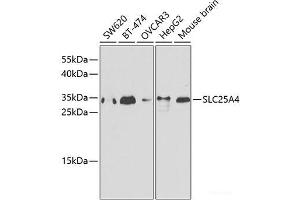 Western blot analysis of extracts of various cell lines using SLC25A4 Polyclonal Antibody. (SLC25A4 antibody)