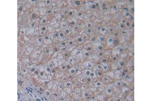 Used in DAB staining on fromalin fixed paraffin- embedded liver tissue (ABCB10 antibody  (AA 492-738))