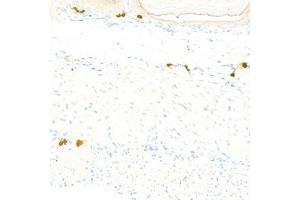 Immunohistochemistry analysis of paraffin-embedded mousestomachusing Chymase (ABIN7073506) at dilution of 1:1000 (CMA1 antibody)